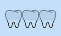 Unsichtbare Zahnspange/Invisalign