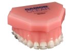 Keramikbrackets